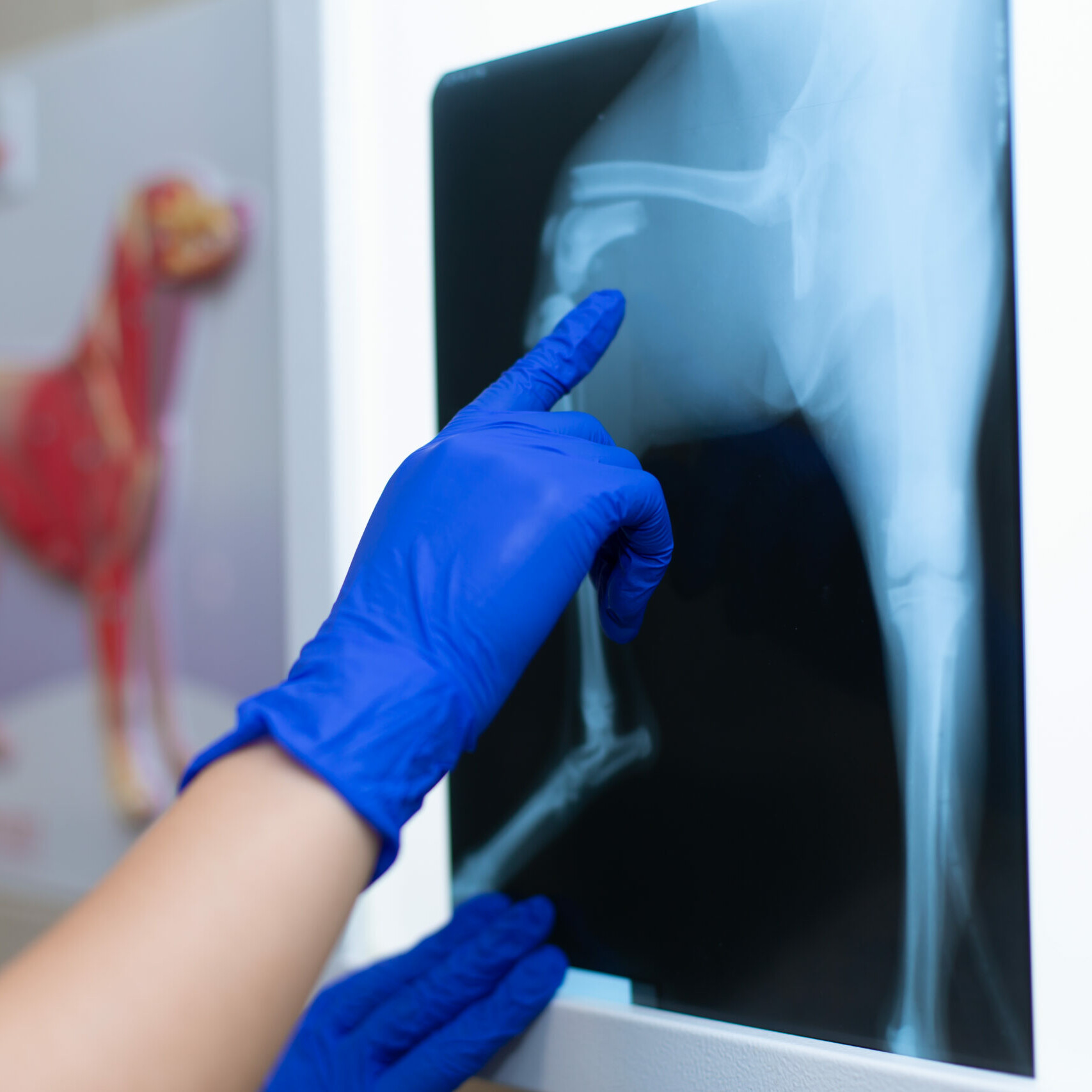 Befunden eines Röntgenbildes